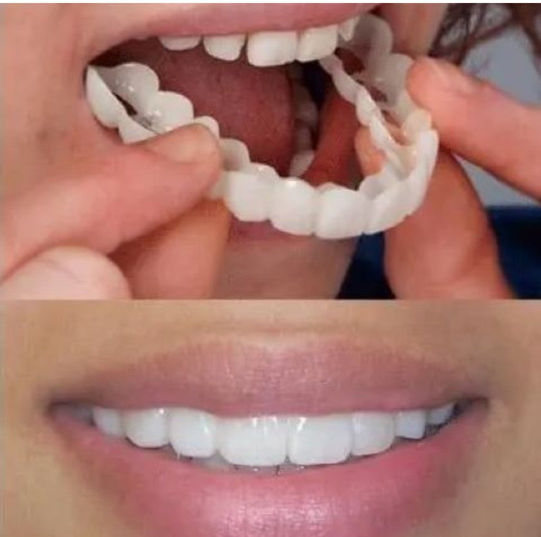 更新:79769574 (1set/1套) 仿真牙套上下排套裝 trusmile veneers both upper & lower teeth #PDC 661646